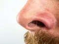 Zbliżenie na nos z widocznymi porami i zarostem. Skóra wokół nozdrzy wymaga głębokie wągry usuwanie.