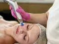 Zabieg dermapen na twarzy kobiety w ciąży, wykonywany przez kosmetyczkę w różowych rękawiczkach.