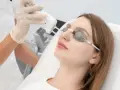 Fizykoterapia laserowa w klinice. Czas zabiegu laserem na twarz, pacjentka w okularach ochronnych.