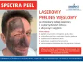 Przed i po laserowym peelingu węglowym: połowa twarzy pokryta czarną maską węglową, druga połowa czysta. Efekt odświeżenia i oczyszczenia.