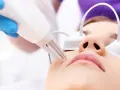 Specjalista w niebieskiej rękawiczce używa lasera do usuwania pieprzyków z twarzy pacjentki.