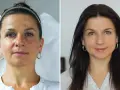 Przed i po zabiegu: skóra z niedoskonałościami i przebarwieniami staje się gładka i promienna. Fibryna pod oczy zdziałała cuda!