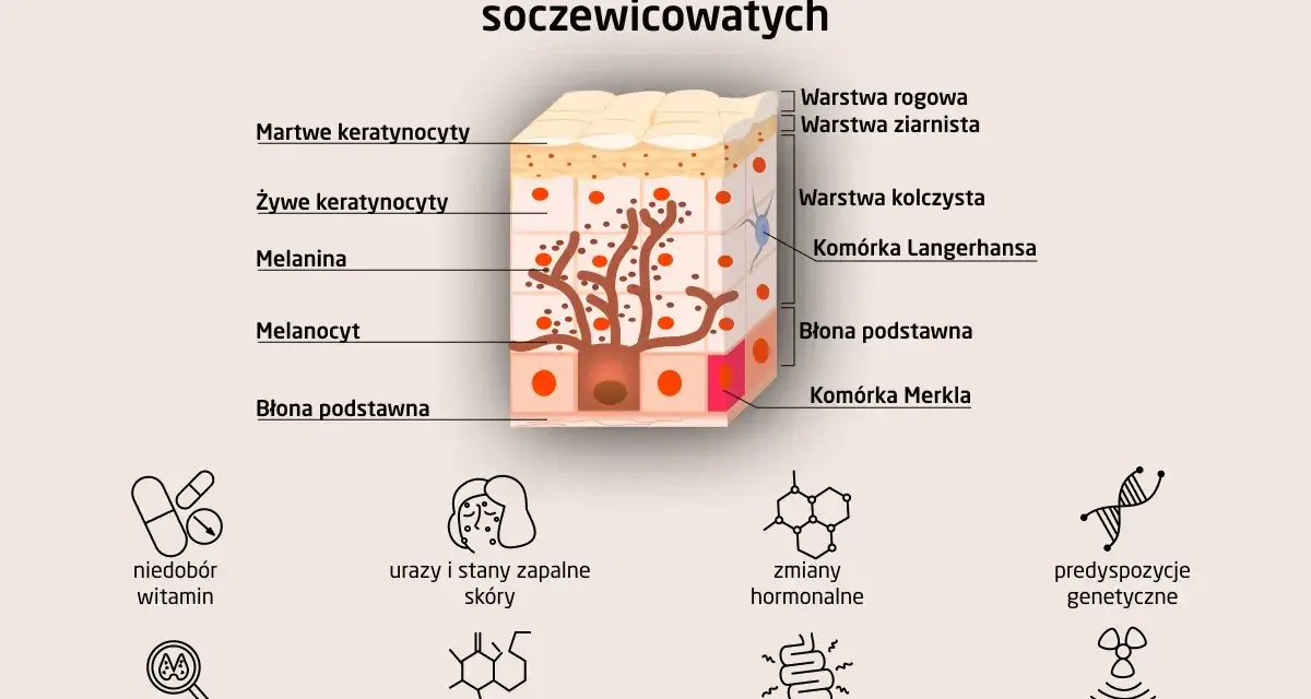 Schemat wyjaśnia, jak wyglądają plamy wątrobowe, pokazując budowę skóry i czynniki wpływające na powstawanie przebarwień.