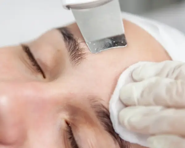 Peeling kawitacyjny usuwa zaskórniki, pozostawiając skórę gładką. Efekty widoczne od razu!