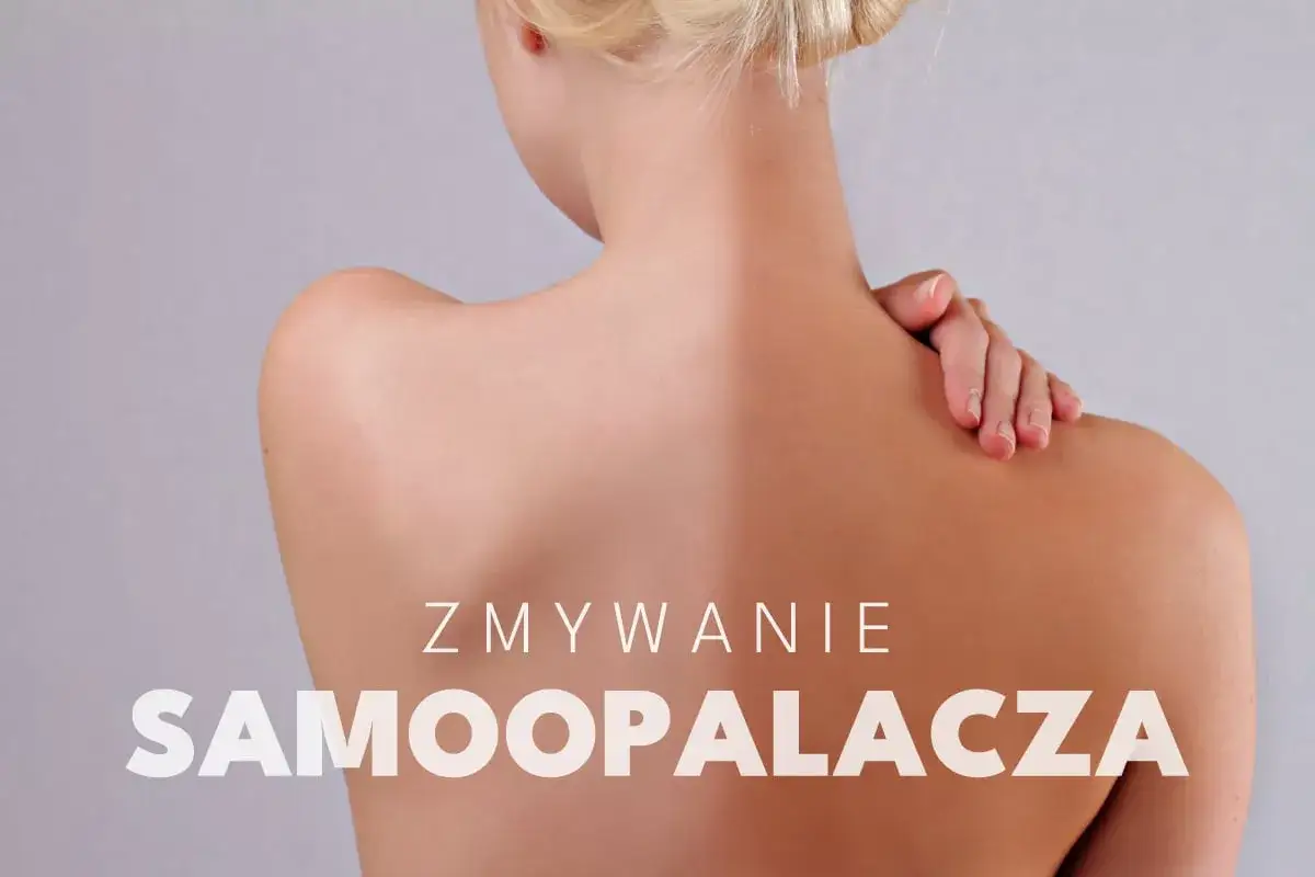 Widok z tyłu na plecy kobiety z nierównomiernym odcieniem skóry, sugerującym plamy po opalaniu natryskowym. Napis 