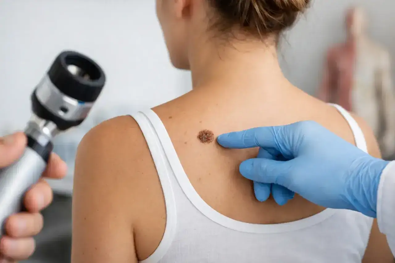 Dermatolog bada pieprzyk na plecach pacjentki, oceniając, jakie zmiany na skórze są niebezpieczne.